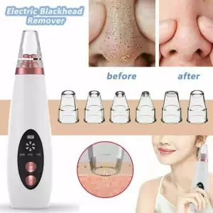 Rechargeable Electric Blackhead Removal
