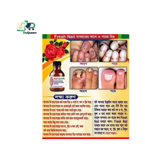 Fresh Nail (Nail repair Oinment)-30gm